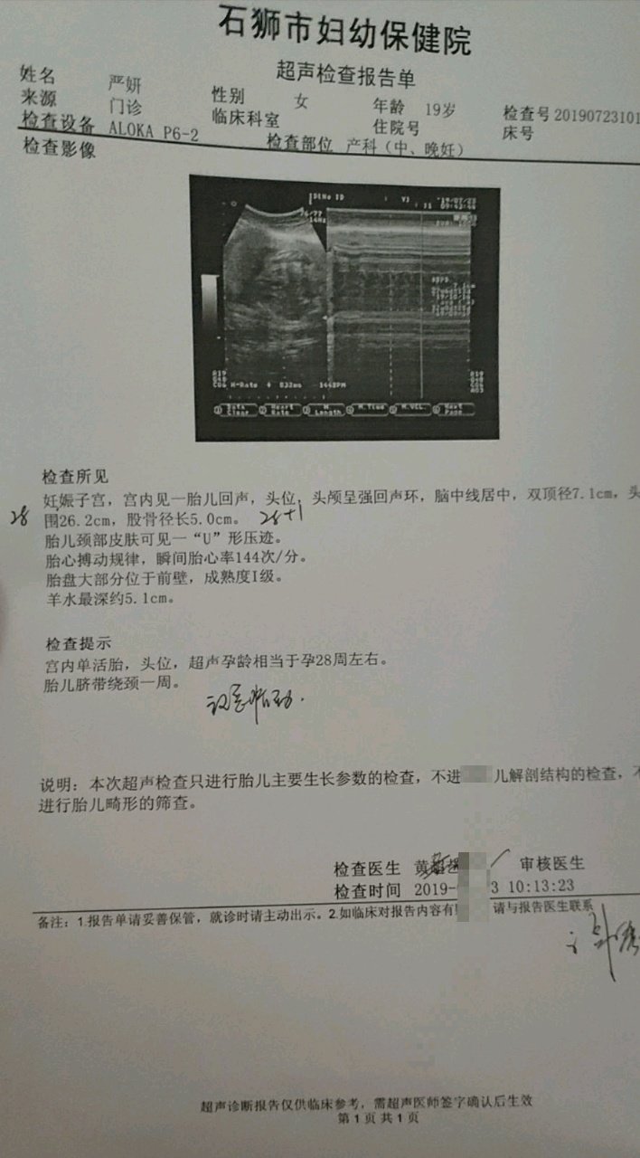 7个多月，宝宝绕颈😭