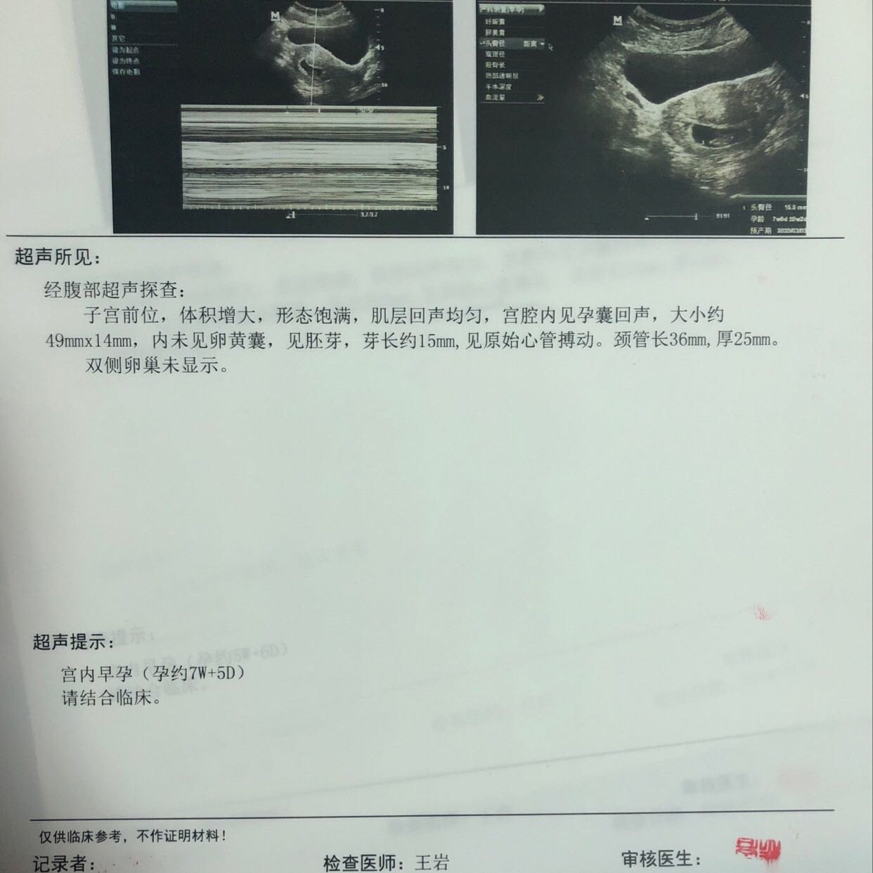 【新手报到】想问问各位宝妈，我这比超正常吗，