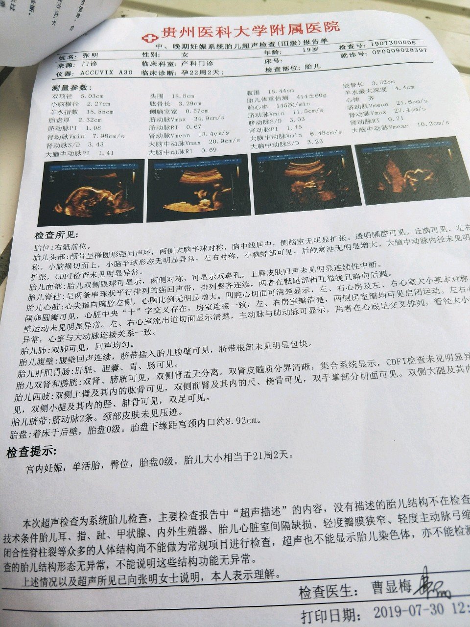 B超上小一周气死我了