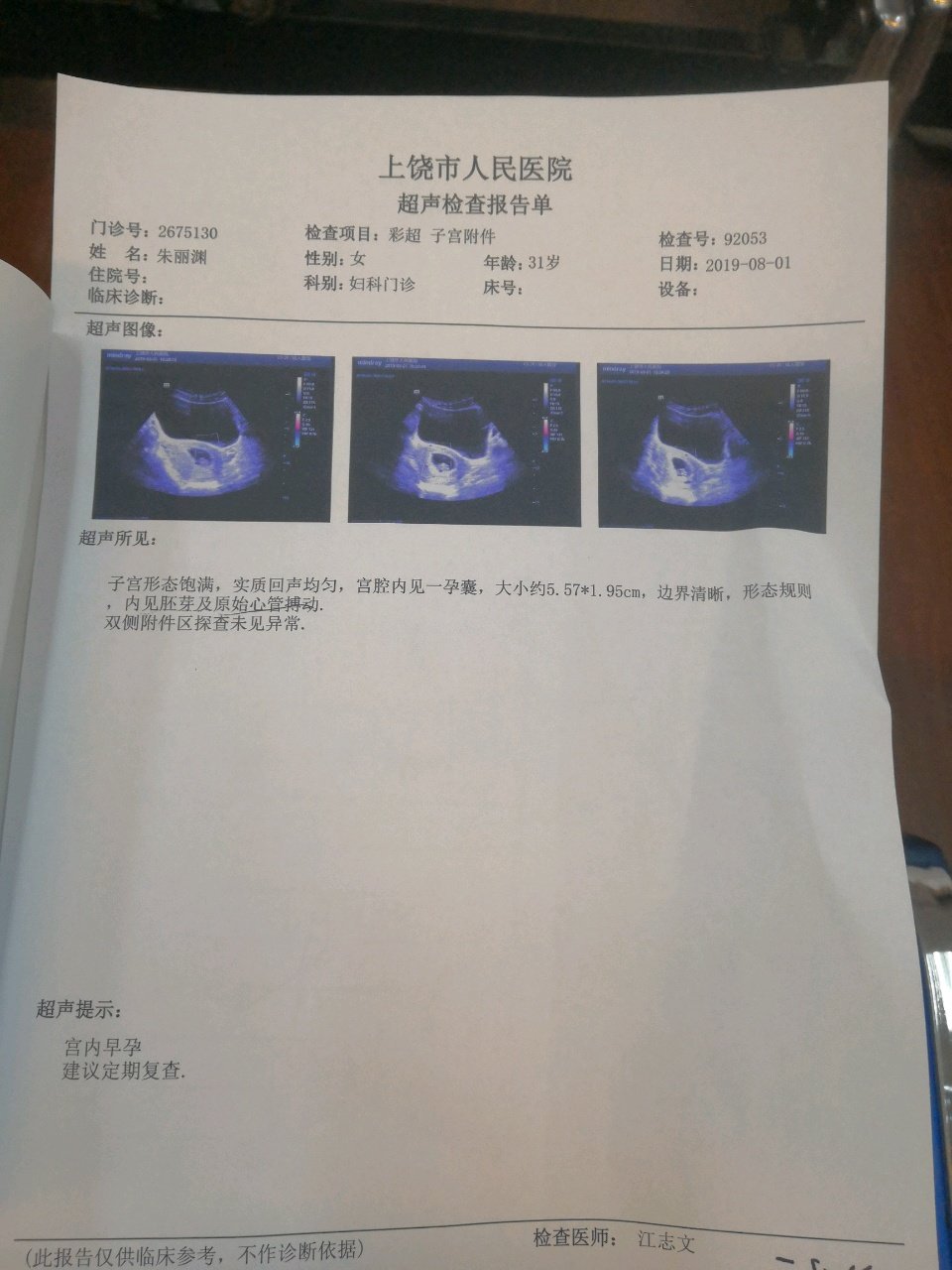 今天去医院检查  看到这个结果  好开心