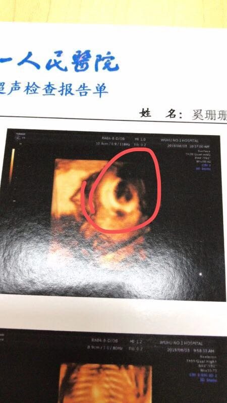 麻烦孕妈们看一下