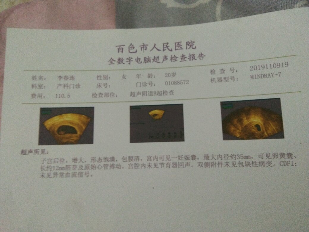【新手报到】能帮我看看现在是多少周了，现在有点记不得月经什么时候停了