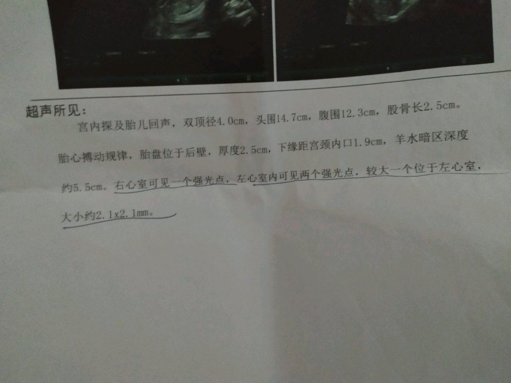【新手报到】查询染色体