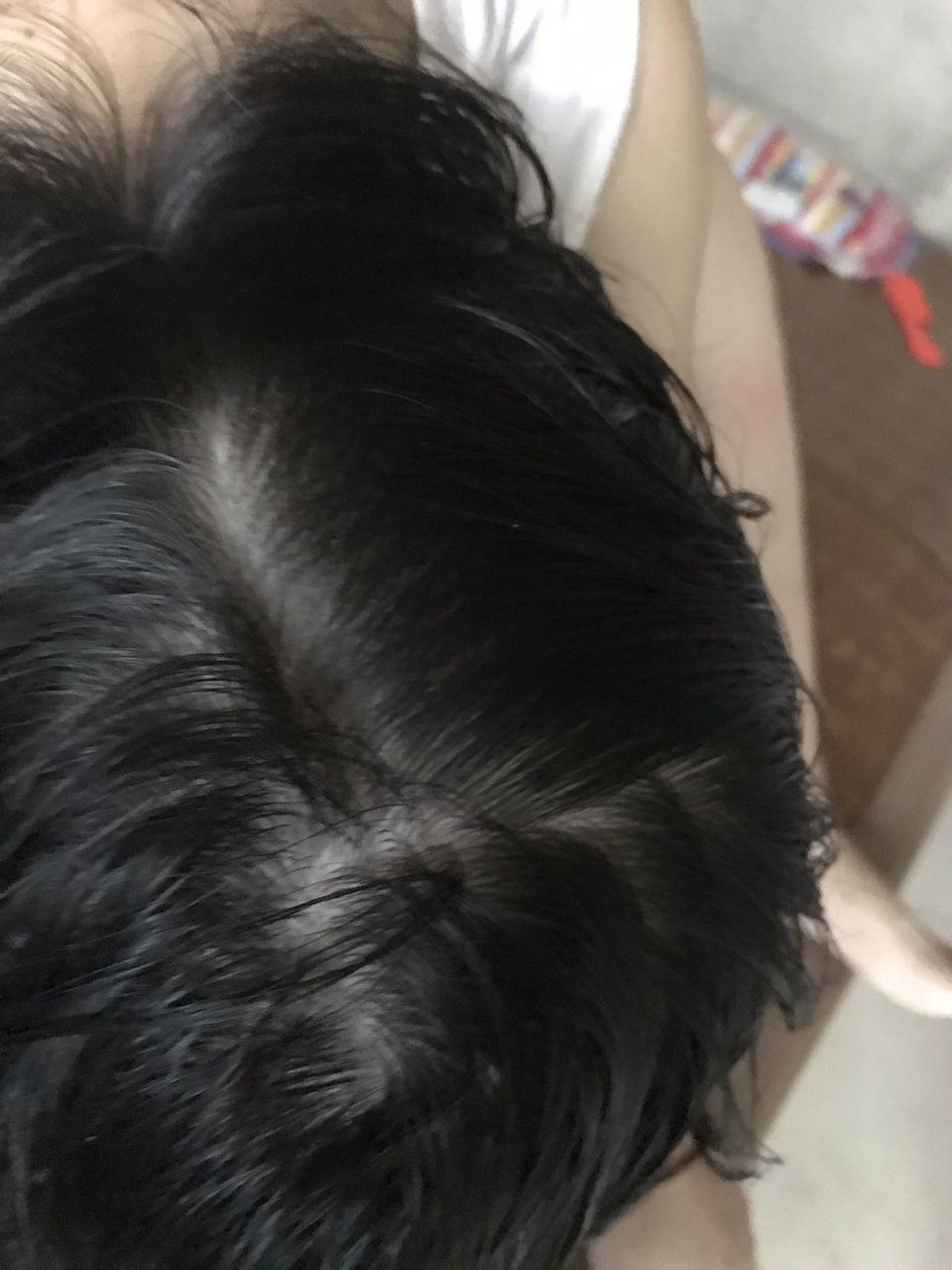掉头发