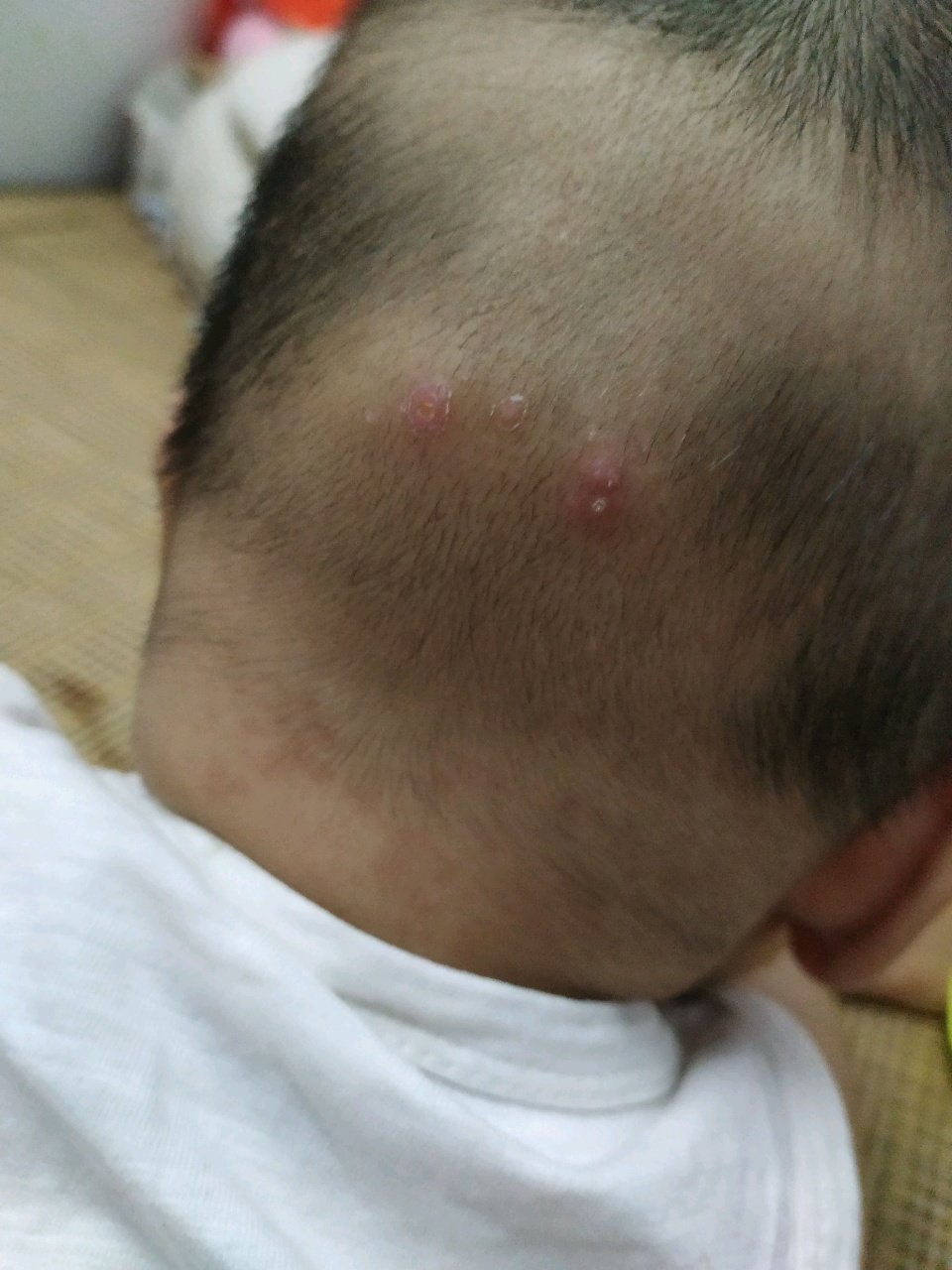 有宝妈遇到宝宝这种情况吗