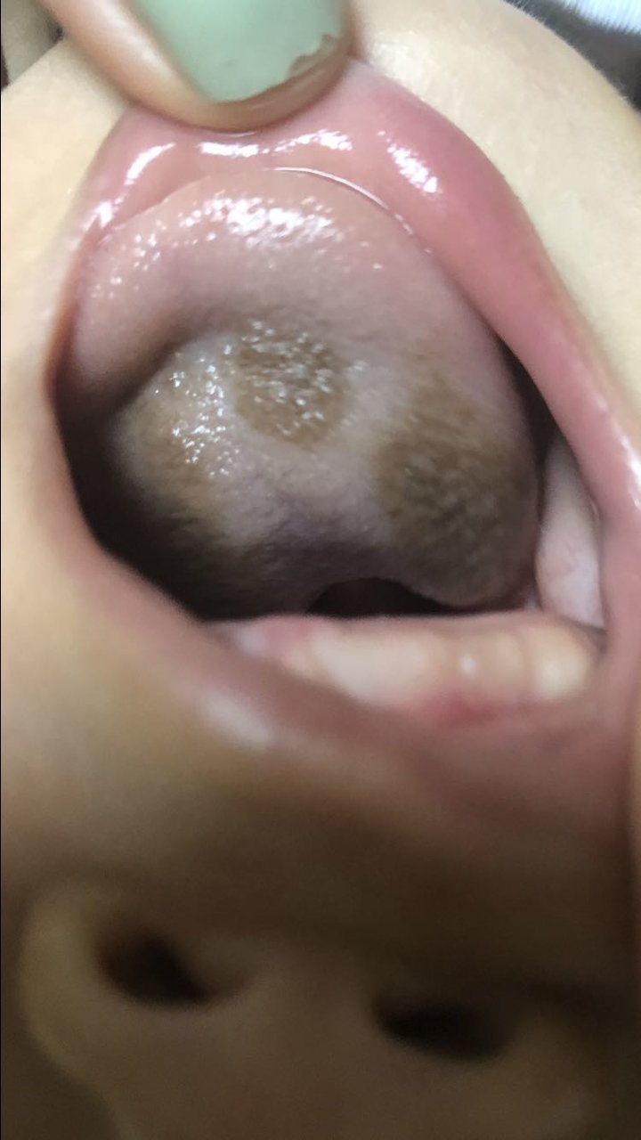 宝妈们有遇到这样情况的么