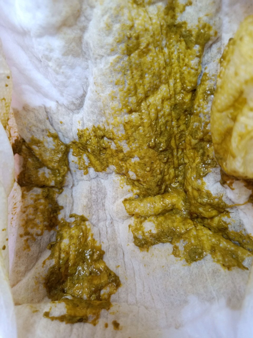 美丽的宝妈们看过来，帮看看这粑粑正常吗