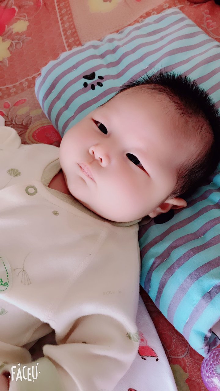 四个半月宝宝  有点对眼  怎么办？？