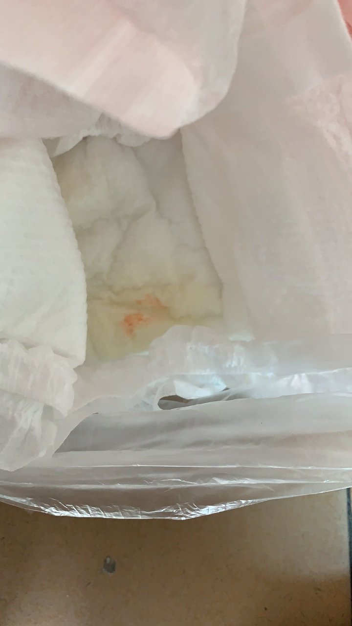 宝宝四个半月拉尿带点红，