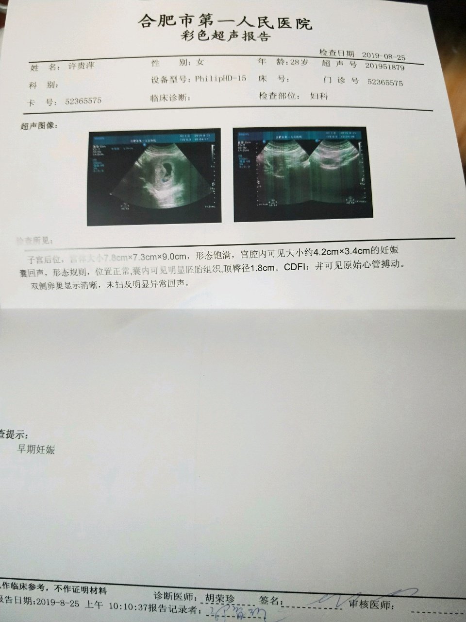 终于有胎心了，可以睡个安稳觉了