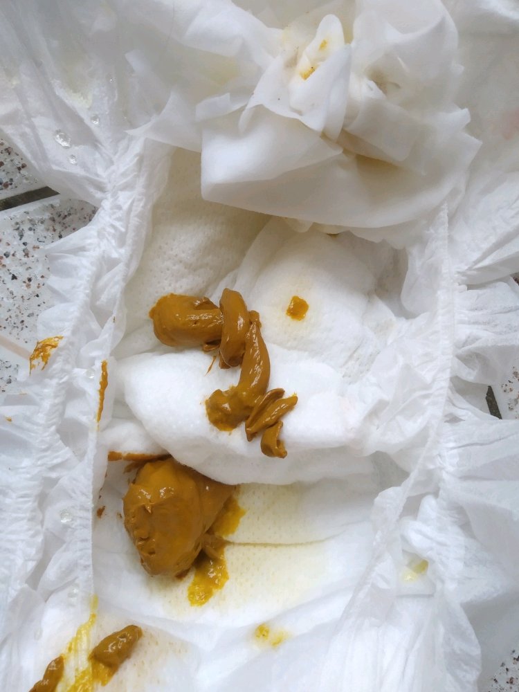 拉这样的屎是攒肚子吗？