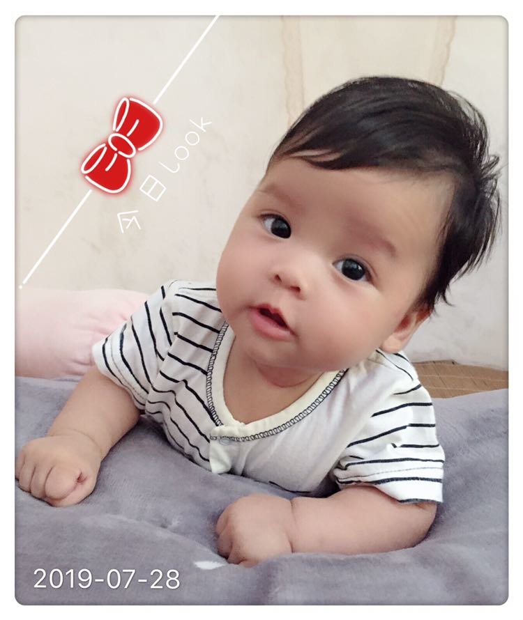 怎么双眼皮说没就没了😔