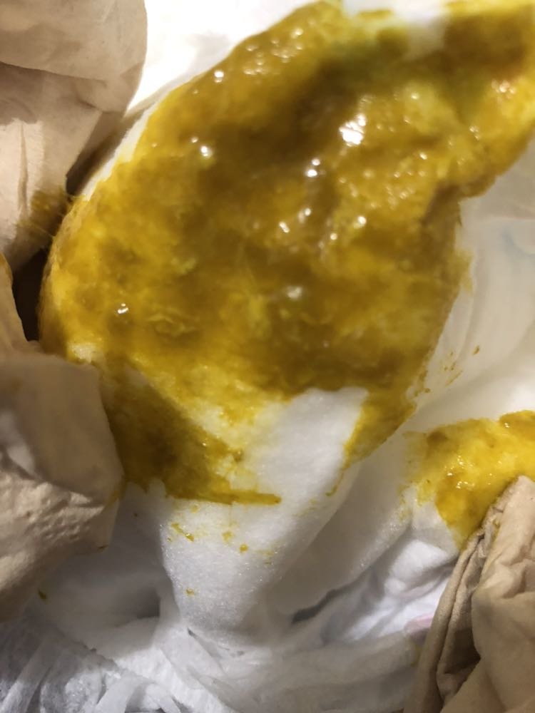 七个月宝宝拉的黄色像豆腐渣的粑粑咋回事