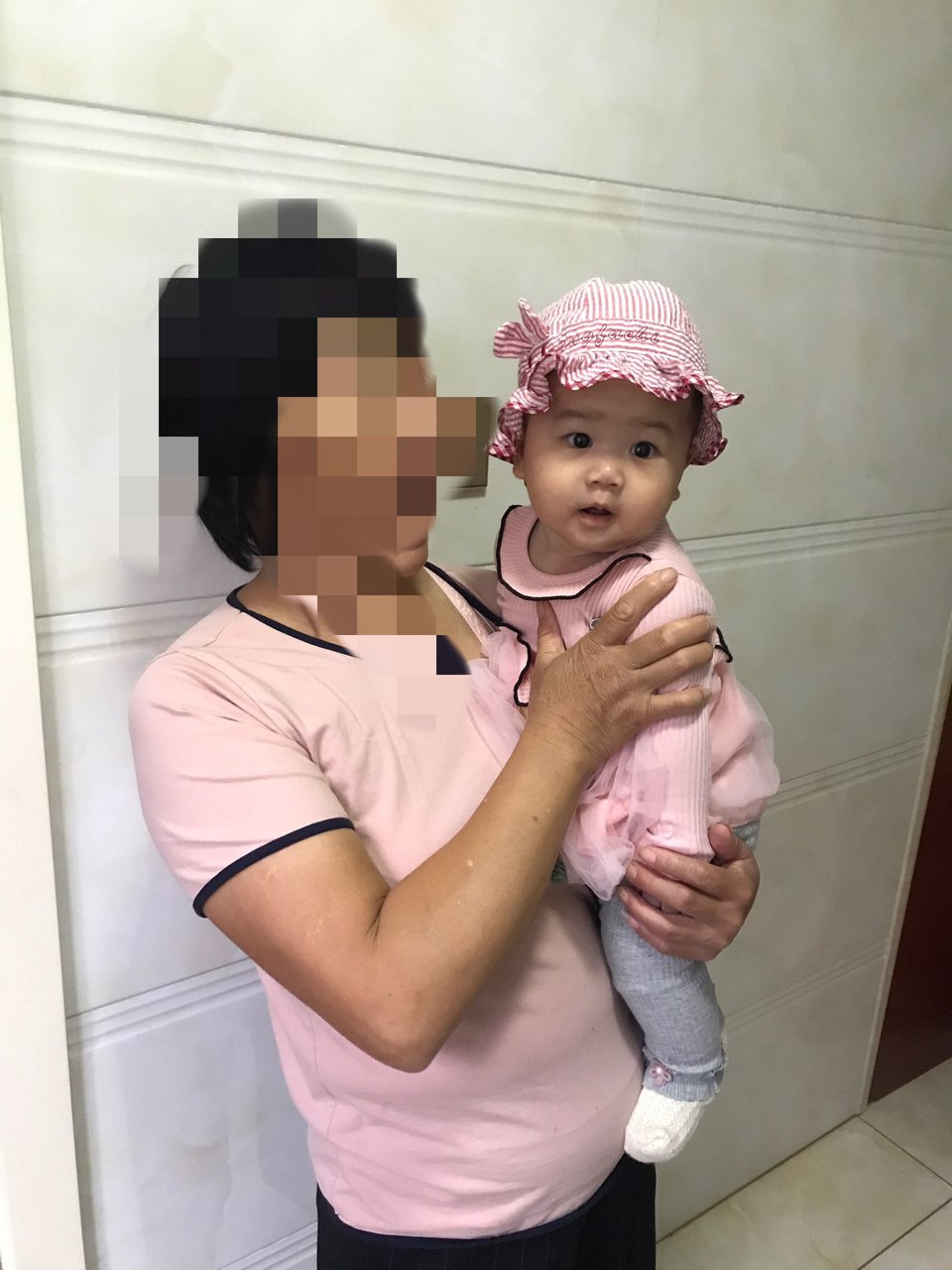 这样还能看出来我的胎记吗？