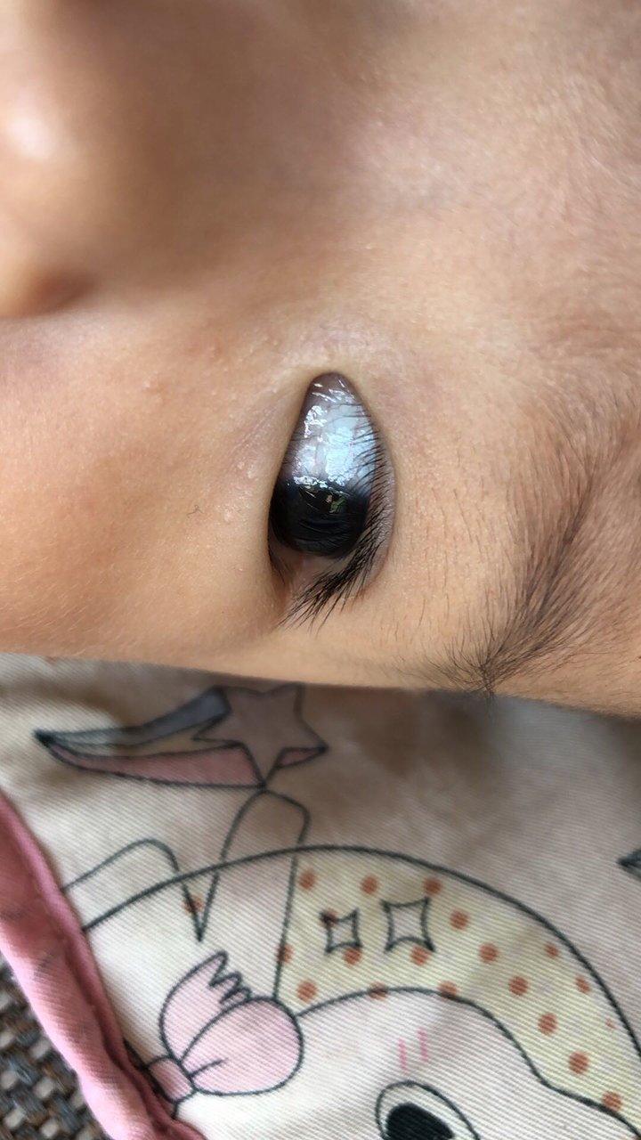 宝贝黑眼球边起来白色的东西