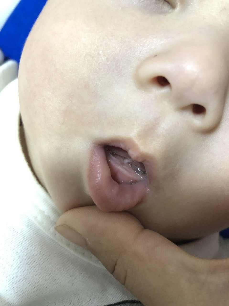 有没有长牙的宝宝啊？
