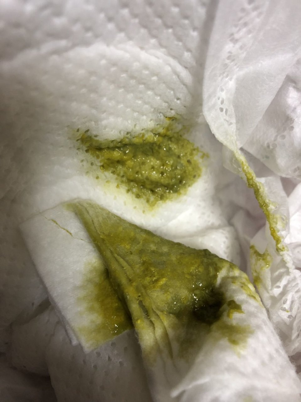 宝宝五个月 拉绿便 偶尔有沫
