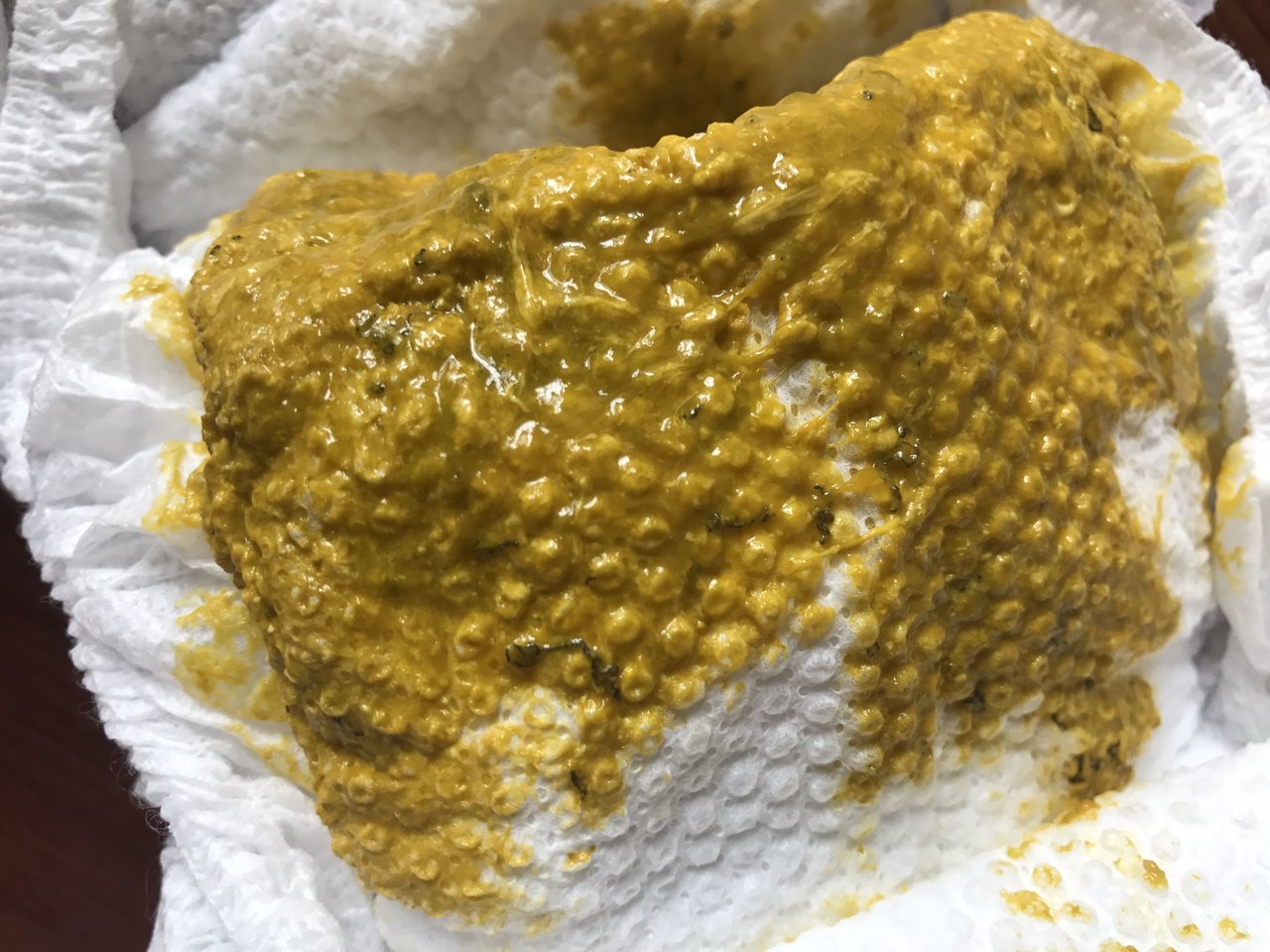 5个月宝宝吃香蕉后拉粑粑是这样的吗？