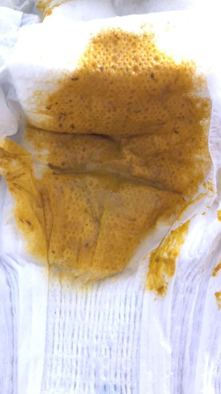 五个半月宝宝拉臭臭有黑线条
