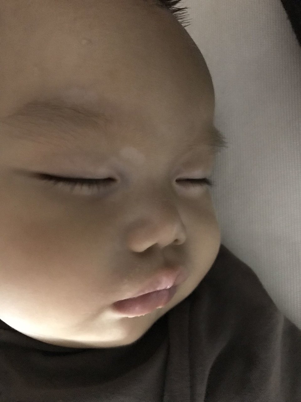 八个月宝宝的眼框有白班，，是白癫疯吗