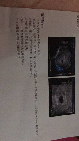 journal_insert_pic_1336923101