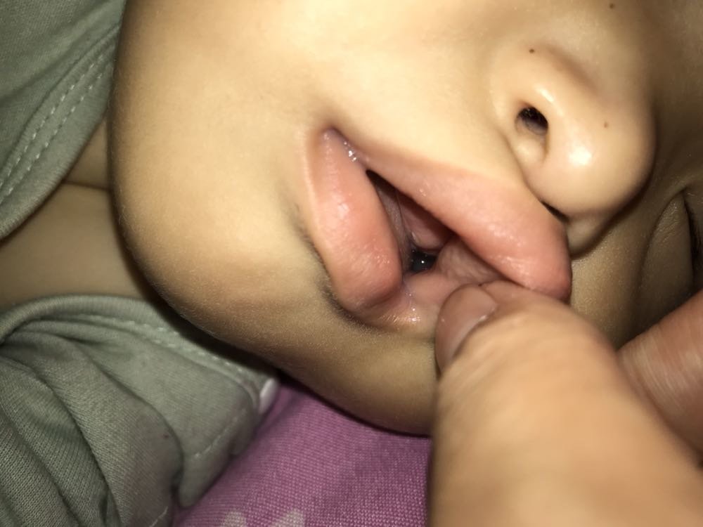 长牙