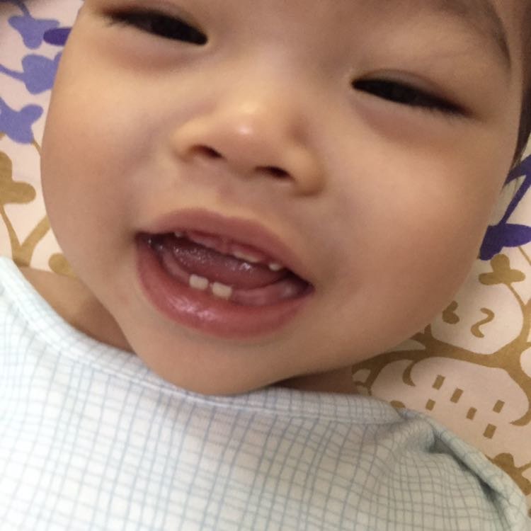 麻烦帮我看下这是就长门牙吗？