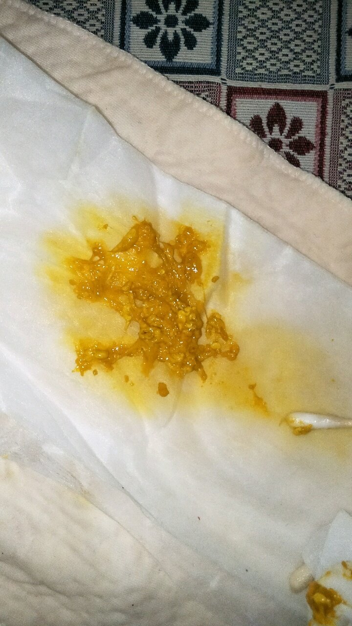 出生九天的宝宝拉的这个，合适吗，基本尿一次就拉一次