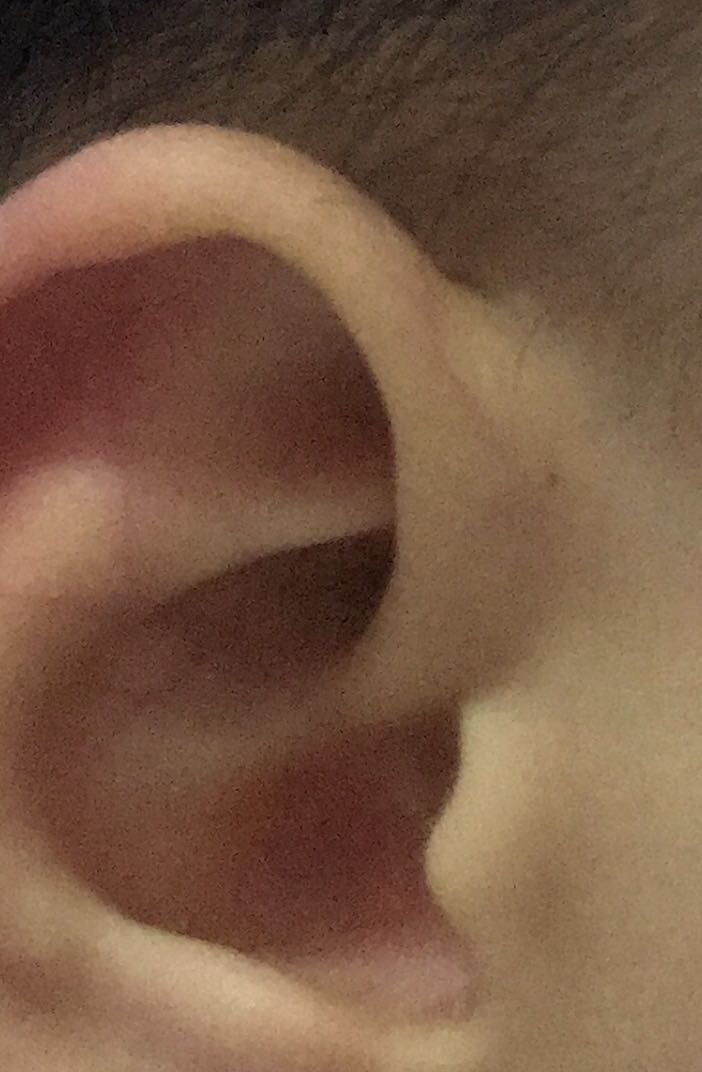 耳朵上有个黑点，