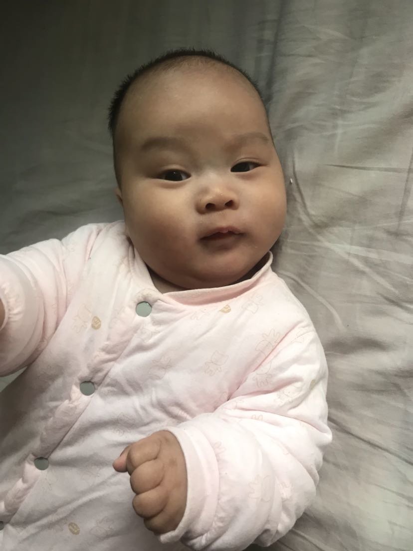 湿疹宝宝很头疼