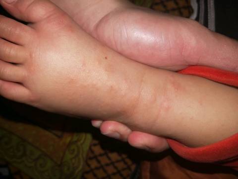 脚底手心都有那位高人这是什么?急!急!急!在线等!