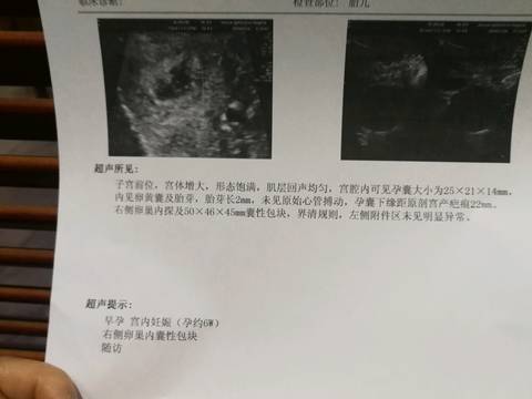 journal_insert_pic_1397343712