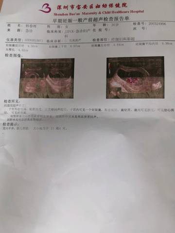 journal_insert_pic_1409081552