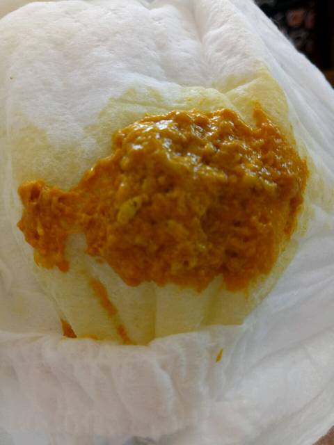 拉奶瓣_亲爱的各位宝妈们我家宝宝17天拉这样的便便正常吗!拉_宝宝树