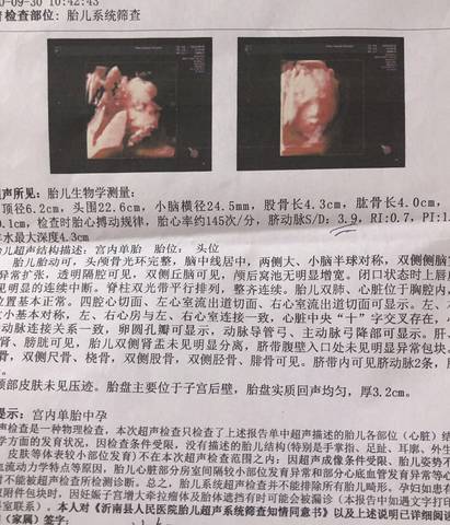 journal_insert_pic_1487028245