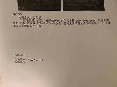 journal_insert_pic_1503591158