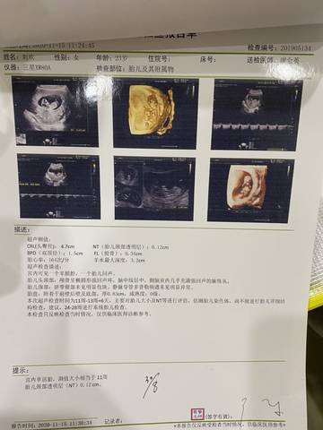 journal_insert_pic_1505563722