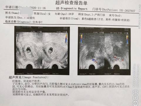 偏右侧宫角回正啦 宝宝树