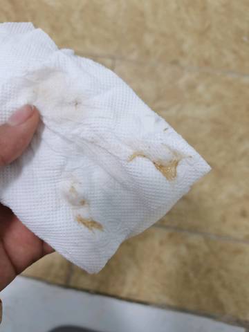 孕9 4出血打了两天黄体酮 今天下面又出现这样的分泌物 怎么办呀?
