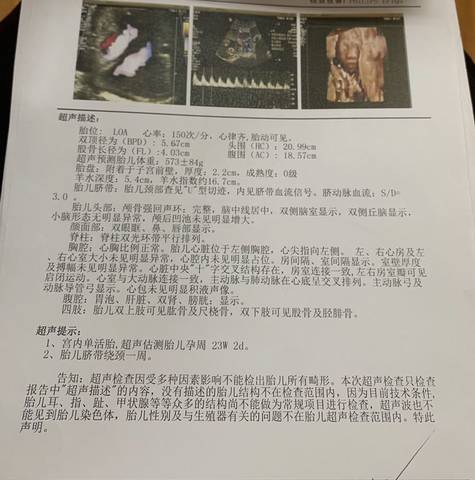 journal_insert_pic_1529192305