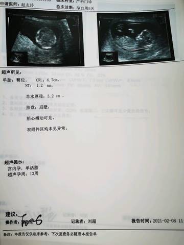 5mm crl6.7正常吗?