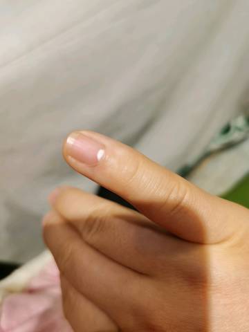 指甲白色蛔虫卵图片图片
