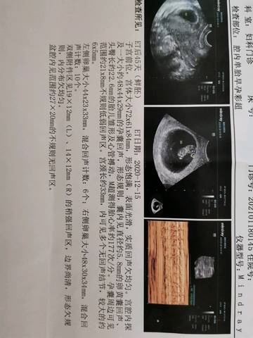 journal_insert_pic_1542457206