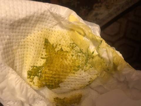 夹杂着绿色的粘液 请教各位有经验的宝爸宝妈一下 宝宝现在纯母乳喂养