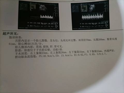 journal_insert_pic_1545129603