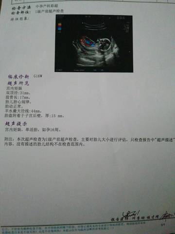 journal_insert_pic_1546139643