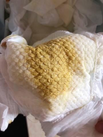 5个月17天宝宝拉肚子一天3到4次 拉水状那样 体重也不涨 怎么办啊