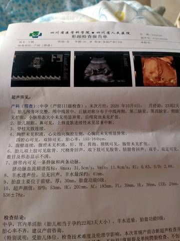 journal_insert_pic_1552717466