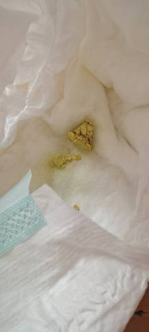 这种粑粑正常吗