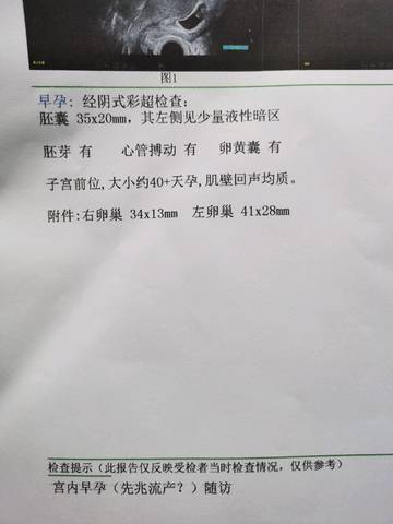 journal_insert_pic_1554493052